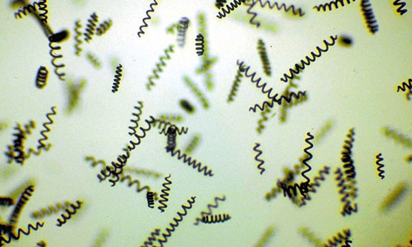 spirulina-microscope.jpg : [피핑락 계란 대용] 단백질 보고 스피루리나 500mg 2병 (한국돈 18944원/5달라)